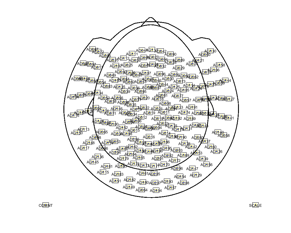 ../../../_images/6-meg-pipeline-gallery_notebooks_fieldtrip_fieldtrip_kit_restingstate_9_1.png