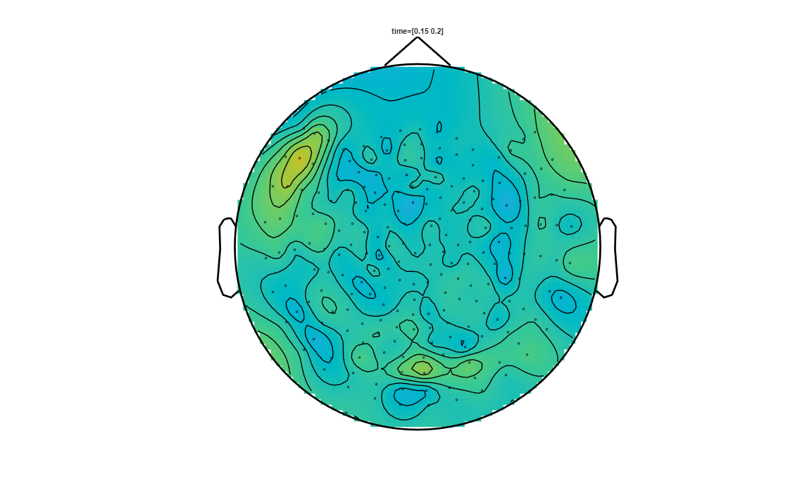 ../../../_images/6-meg-pipeline-gallery_notebooks_fieldtrip_fieldtrip_kit_spatio-temporal-clustering_23_4.png