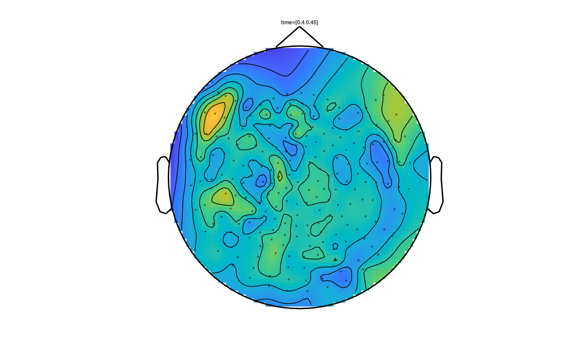 ../../../_images/6-meg-pipeline-gallery_notebooks_fieldtrip_fieldtrip_kit_spatio-temporal-clustering_33_10.png