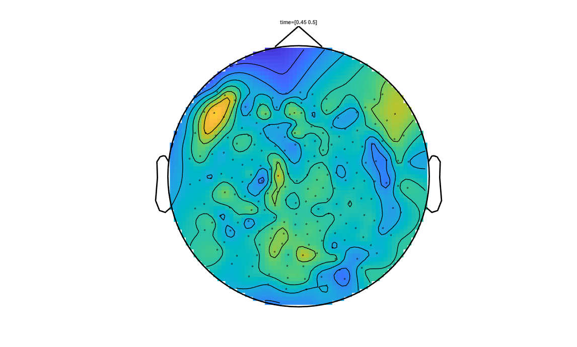 ../../../_images/6-meg-pipeline-gallery_notebooks_fieldtrip_fieldtrip_kit_spatio-temporal-clustering_33_11.png