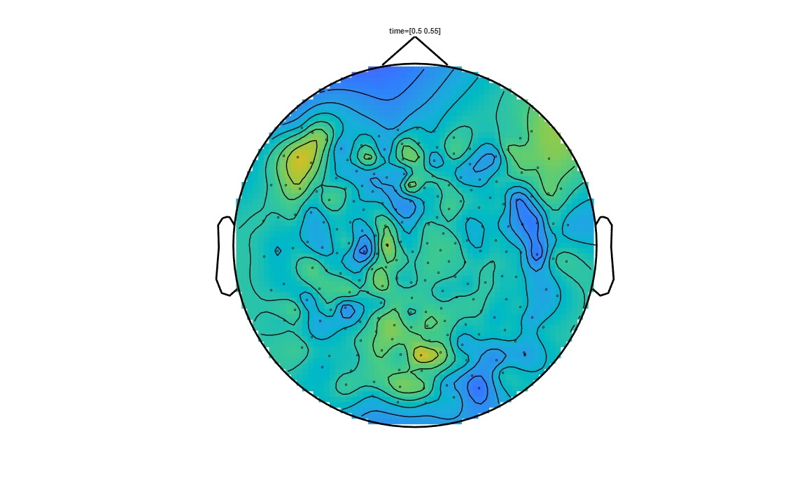 ../../../_images/6-meg-pipeline-gallery_notebooks_fieldtrip_fieldtrip_kit_spatio-temporal-clustering_33_12.png