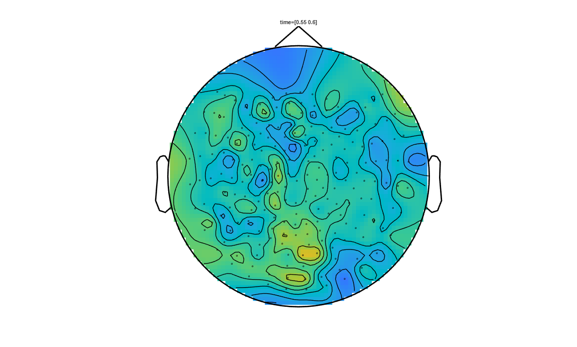 ../../../_images/6-meg-pipeline-gallery_notebooks_fieldtrip_fieldtrip_kit_spatio-temporal-clustering_33_13.png