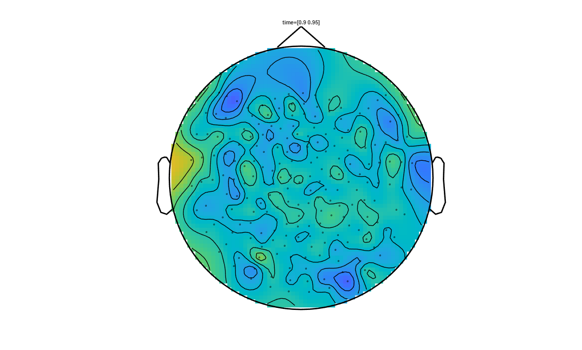 ../../../_images/6-meg-pipeline-gallery_notebooks_fieldtrip_fieldtrip_kit_spatio-temporal-clustering_33_20.png