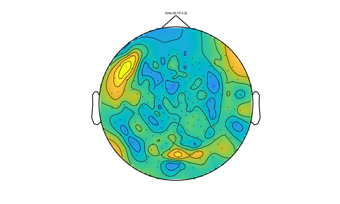 ../../../_images/6-meg-pipeline-gallery_notebooks_fieldtrip_fieldtrip_kit_spatio-temporal-clustering_33_5.png