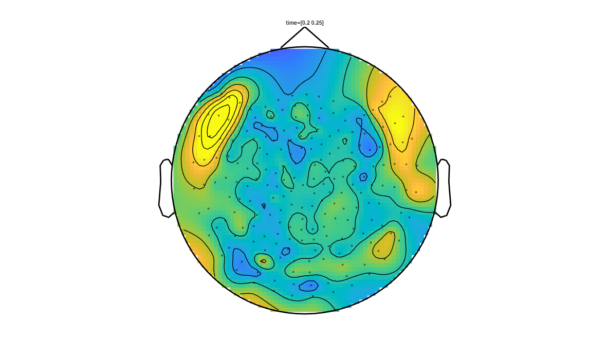 ../../../_images/6-meg-pipeline-gallery_notebooks_fieldtrip_fieldtrip_kit_spatio-temporal-clustering_33_6.png