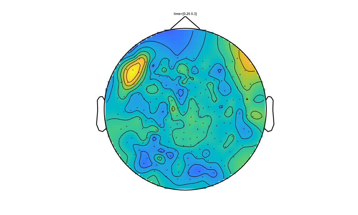 ../../../_images/6-meg-pipeline-gallery_notebooks_fieldtrip_fieldtrip_kit_spatio-temporal-clustering_33_7.png