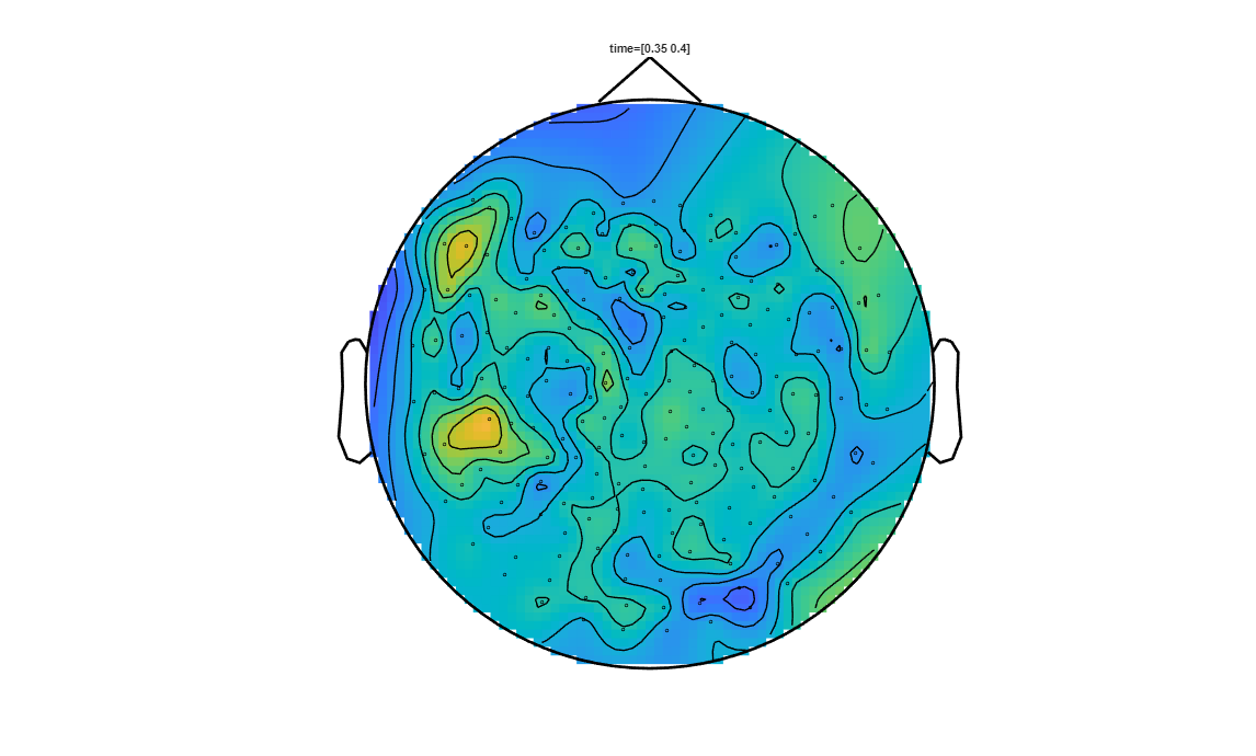 ../../../_images/6-meg-pipeline-gallery_notebooks_fieldtrip_fieldtrip_kit_spatio-temporal-clustering_33_9.png