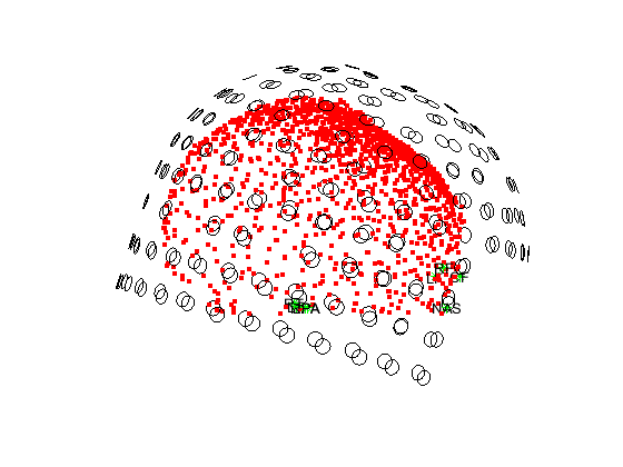 ../../../_images/6-meg-pipeline-gallery_notebooks_fieldtrip_fieldtrip_oddball_KIT_pipeline_37_0.png