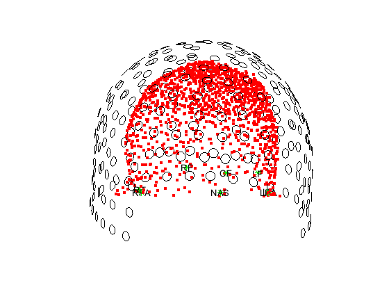 ../../../_images/6-meg-pipeline-gallery_notebooks_fieldtrip_fieldtrip_oddball_KIT_pipeline_40_0.png