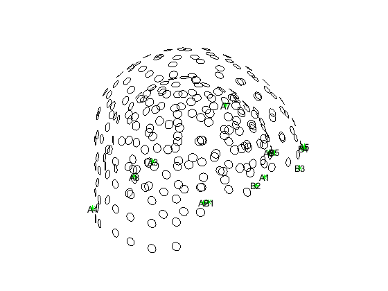 ../../../_images/6-meg-pipeline-gallery_notebooks_fieldtrip_fieldtrip_oddball_OPM_pipeline_66_1.png