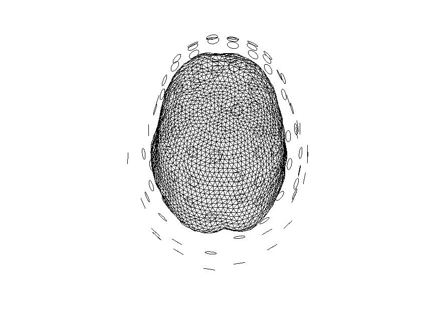 ../../../_images/6-meg-pipeline-gallery_notebooks_fieldtrip_fieldtrip_oddball_OPM_pipeline_95_0.png