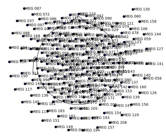 ../../../_images/6-meg-pipeline-gallery_notebooks_mne_mne_kit_resting_state_pipeline_12_0.png