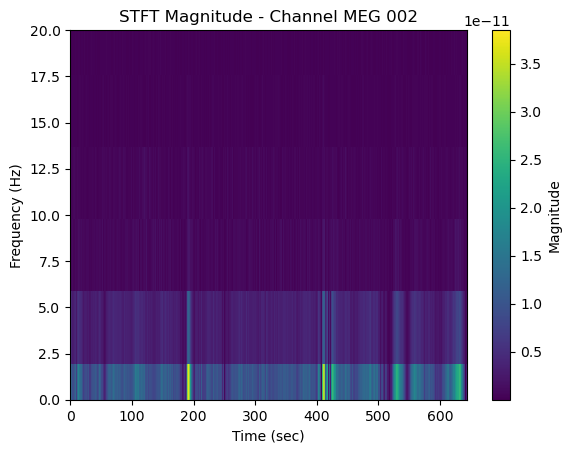 ../../../_images/6-meg-pipeline-gallery_notebooks_mne_mne_kit_resting_state_pipeline_35_1.png