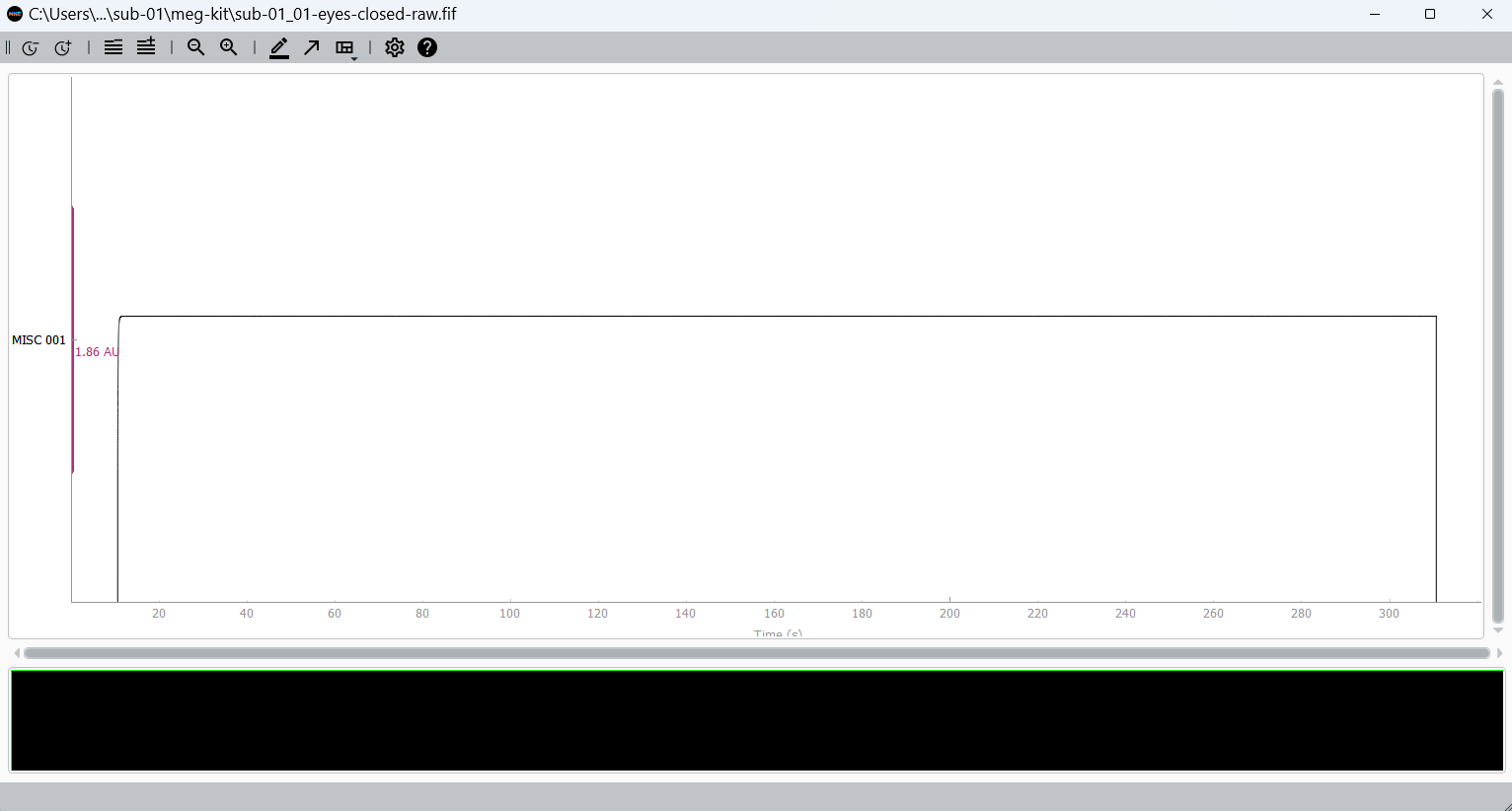 Trigger visualisation