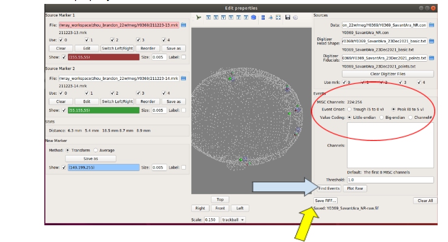 AI generated MEG-system image