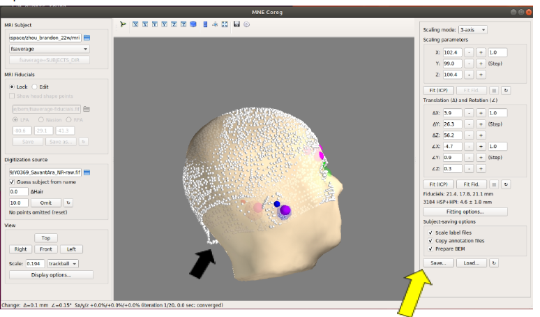 AI generated MEG-system image